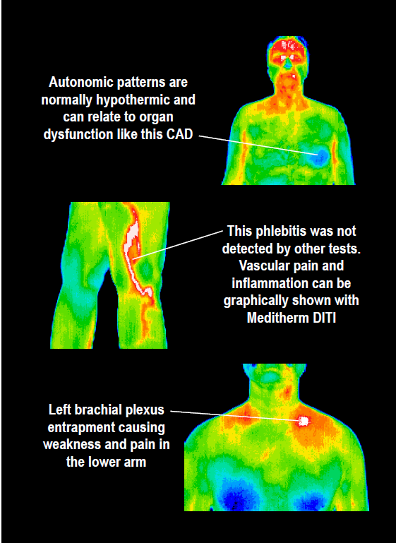 Thermal body scanner deals